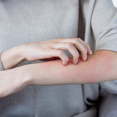 Urticaria & Itch Clinic image